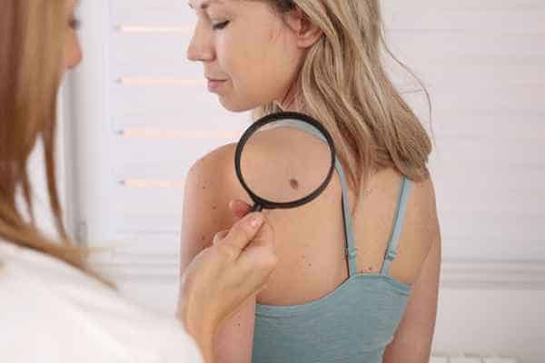 What Are Traditional Skin Lesion Removal Methods Bingley?