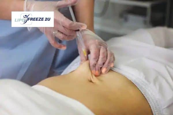 Fat Dissolving Injections Bingley & Weight loss medication